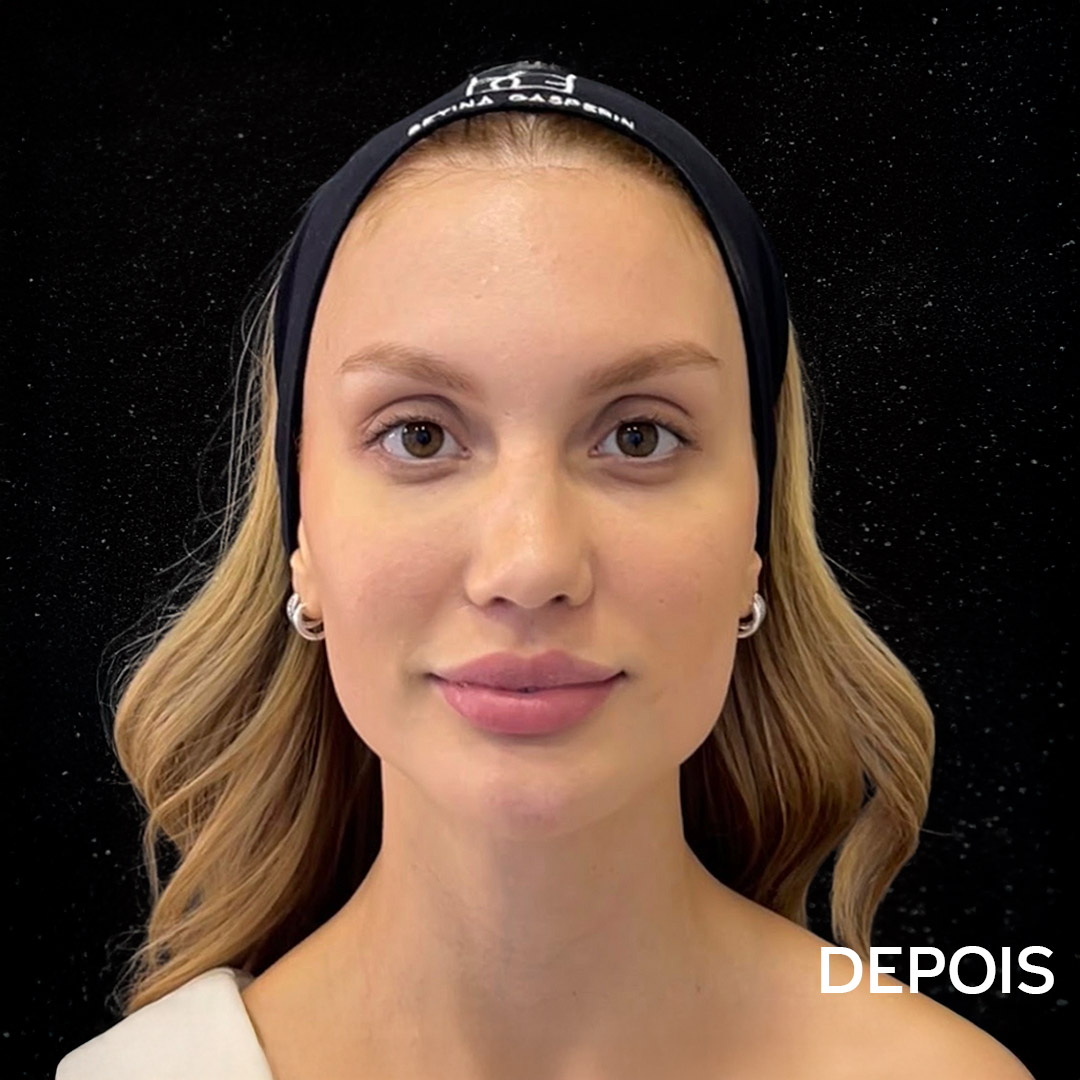[Imagem de Depois]